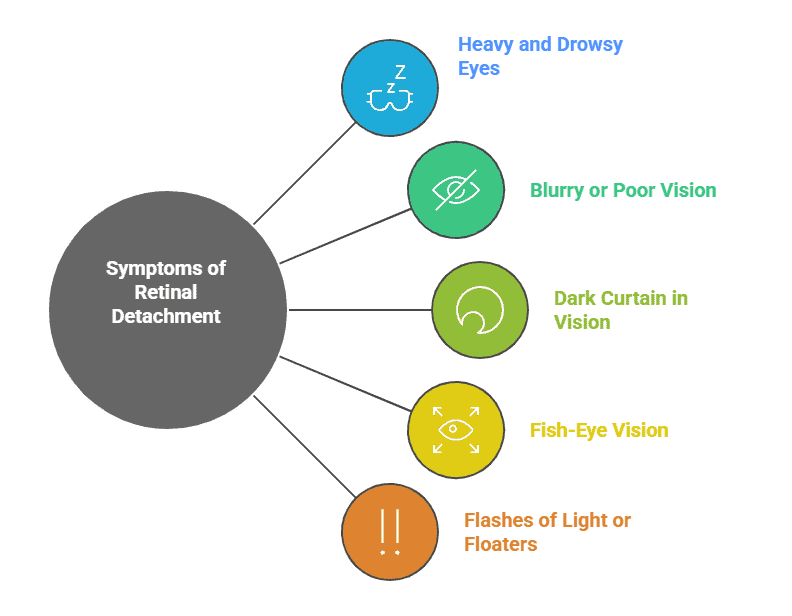 Symptoms and Signs of Retinal Detachment