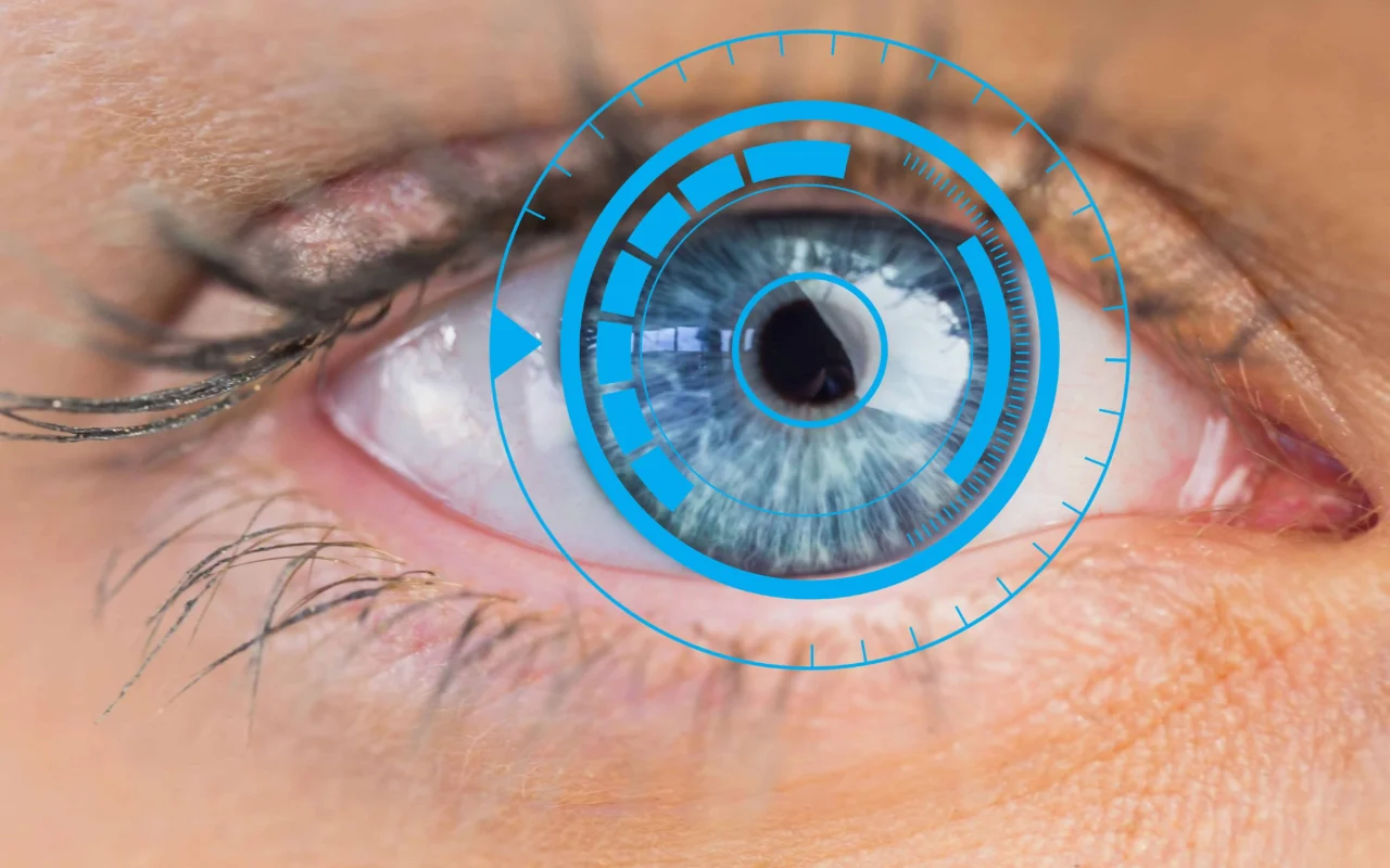 LASIK eye surgery terms
