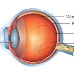 Age Related Macular Degeneration