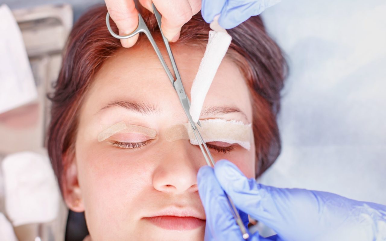 Blepharoplasty surgery