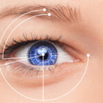 ICL vs LASIK surgery