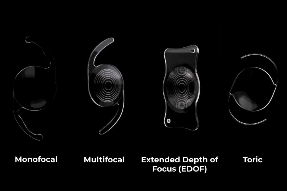 types of cataract lens