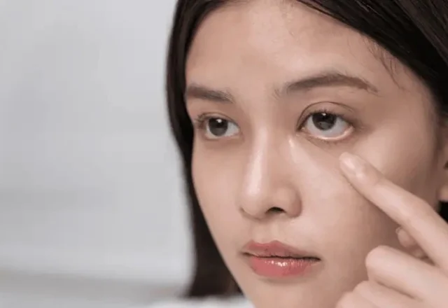 What are Eye Allergies