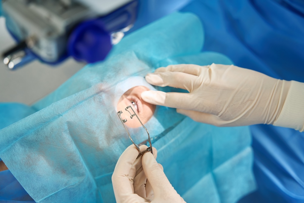 Reflective Lens Exchange Surgery